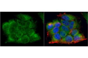 Immunofluorescence (IF) image for anti-Lactate Dehydrogenase A (LDHA) antibody (ABIN2855034)