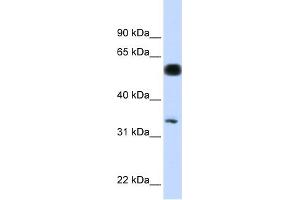 WB Suggested Anti-C19orf62 Antibody Titration: 0. (BRISC and BRCA1 A Complex Member 1 (BABAM1) (N-Term) Antikörper)