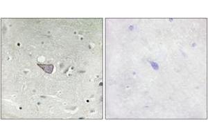 Immunohistochemistry (IHC) image for anti-Armadillo Repeat Containing, X-Linked 3 (ARMCX3) (AA 291-340) antibody (ABIN2889794) (ARMCX3 Antikörper  (AA 291-340))