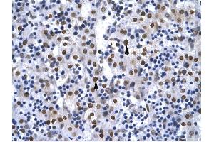 G22P1 antibody was used for immunohistochemistry at a concentration of 4-8 ug/ml to stain Hepatocytes arrows) in Human Liver. (XRCC6 Antikörper  (N-Term))