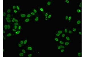 Immunofluorescent analysis of HepG2 cells using ABIN7168366 at dilution of 1:100 and Alexa Fluor 488-congugated AffiniPure Goat Anti-Rabbit IgG(H+L) (FUS Antikörper  (AA 1-198))