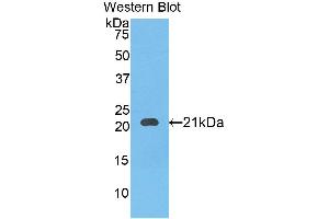 Western blot analysis of the recombinant protein. (SERPINB4 Antikörper  (AA 60-222))