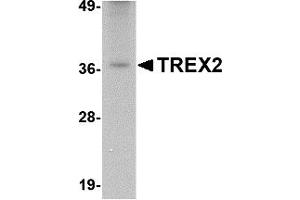 Western Blotting (WB) image for anti-three Prime Repair Exonuclease 2 (Trex2) (C-Term) antibody (ABIN1030770) (TREX2 Antikörper  (C-Term))