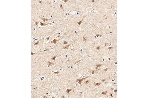 Immunohistochemical analysis of paraffin-embedded human brain tissue using (ABIN655975 and ABIN2845360) performed on the Leica® BOND RXm. (AP1M1 Antikörper  (AA 199-227))
