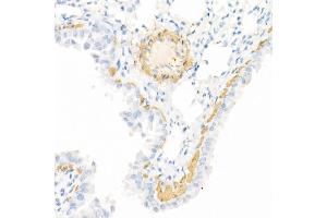 Immunohistochemistry (IHC) image for anti-Caspase 7, Apoptosis-Related Cysteine Peptidase (CASP7) (AA 24-303) antibody (ABIN3022072)
