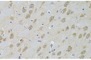 Immunohistochemistry of paraffin-embedded Mouse brain using ADRBK2 Polyclonal Antibody at dilution of 1:100 (40x lens). (ADRBK2 Antikörper)