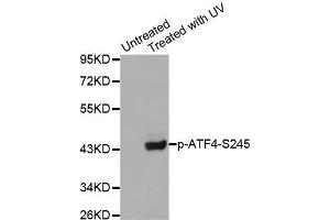 Western blot analysis of extracts from Hela cells using Phospho-ATF4-S245 antibody. (ATF4 Antikörper  (pSer245))