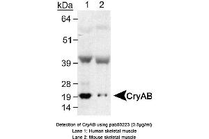 Image no. 1 for anti-Crystallin, alpha B (CRYAB) (AA 100-175), (Internal Region) antibody (ABIN363532) (CRYAB Antikörper  (Internal Region))