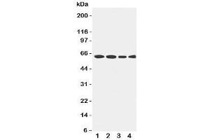 Western blot testing of LCAT antibody and Lane 1:  rat brain;  2: U87;  3: HeLa;  4: SMMC-7721 cell lysate.