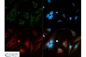 Image no. 5 for anti-Beclin 1, Autophagy Related (BECN1) antibody (ABIN363435) (Beclin 1 Antikörper)