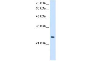 WB Suggested Anti-PPCDC Antibody Titration:  2. (PPCDC Antikörper  (N-Term))