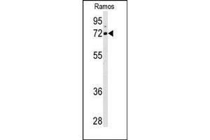 Image no. 1 for anti-Arachidonate 15-Lipoxygenase (ALOX15) (C-Term) antibody (ABIN360266) (ALOX15 Antikörper  (C-Term))