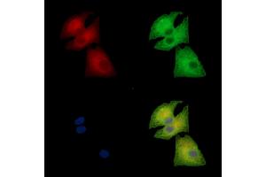 ABIN7095188 and ABIN7099244 staining  cells by IF/ICC. (CLIC5 Antikörper)