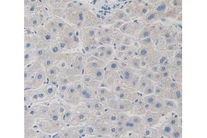 IHC-P analysis of Kidney tissue, with DAB staining. (GRK4 Antikörper  (AA 187-449))