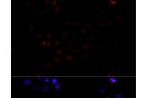 Immunofluorescence analysis of HeLa cells using TBP Polyclonal Antibody at dilution of 1:100 (40x lens). (TBP Antikörper)