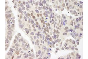 Immunohistochemistry (IHC) image for anti-Zinc Finger Protein 261 (ZMYM3) (AA 250-300) antibody (ABIN7448881)