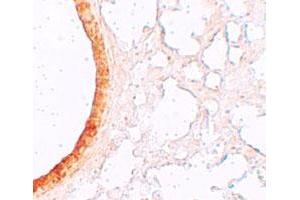 Immunohistochemical staining of mouse lung cells with SLC39A3 polyclonal antibody  at 5 ug/mL. (SLC39A3 Antikörper  (Internal Region))