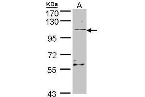 WB Image Sample (30 ug of whole cell lysate) A: Raji , 7. (RGL2 Antikörper)