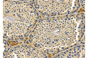 ABIN6259699 and ABIN6279056 at 1/100 staining Mouse testis tissue by IHC-P.