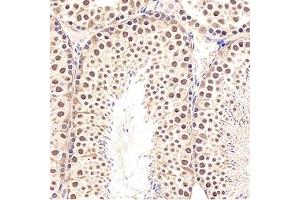 Immunohistochemistry analysis of paraffin-embedded mouse testis using,GTF2F2 (ABIN7074036)at dilution of 1: 3000 (GTF2F2 Antikörper)
