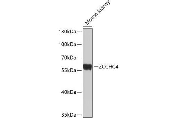 ZCCHC4 Antikörper  (AA 50-220)