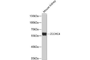 Western blot analysis of extracts of mouse kidney, using ZCCHC4 antibody (ABIN6133077, ABIN6150408, ABIN6150409 and ABIN6214292) at 1:1000 dilution. (ZCCHC4 Antikörper  (AA 50-220))