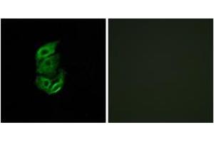 Immunofluorescence analysis of A549 cells, using STA13 Antibody. (STARD13 Antikörper  (AA 101-150))