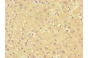 Immunohistochemistry of paraffin-embedded human liver tissue using ABIN7157503 at dilution of 1:100 (KIR2DL3 Antikörper  (AA 22-245))