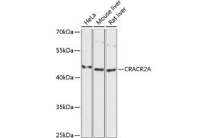Western blot analysis of extracts of various cell lines, using CRA antibody (ABIN6132088, ABIN6139000, ABIN6139002 and ABIN6217974) at 1:3000 dilution. (EFCAB4B Antikörper  (AA 1-200))