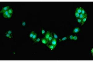 Immunofluorescent analysis of PC-3 cells using ABIN7160449 at dilution of 1:100 and Alexa Fluor 488-congugated AffiniPure Goat Anti-Rabbit IgG(H+L) (FAM168B Antikörper  (AA 43-100))