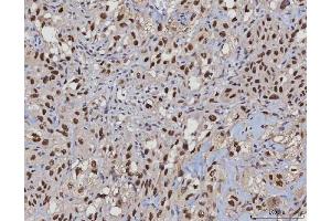 IHC analysis of MSH2 using anti-MSH2 antibody (ABIN7601369). (MSH2 Antikörper  (AA 337-583))