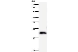 Western Blotting (WB) image for anti-Nucleoporin 93kDa (NUP93) antibody (ABIN931082) (NUP93 Antikörper)