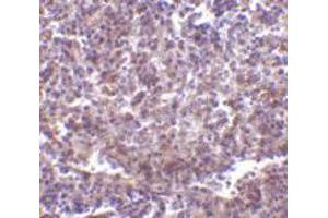 Immunohistochemistry of CD180 in human spleen tissue with CD180 polyclonal antibody  at 2 ug/mL . (CD180 Antikörper  (N-Term))