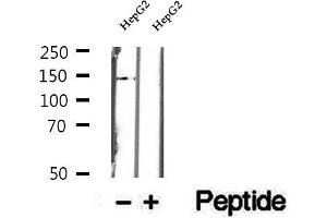 Western blot analysis of extracts of HepG2 cells, using DHX38 antibody. (DHX38 Antikörper  (C-Term))