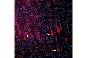 Expression of P2RY6 in rat parietal cortexImmunohistochemical staining of perfusion-fixed frozen rat brain sections with Anti-P2Y6 Receptor (extracellular) Antibody (ABIN7043591, ABIN7045140 and ABIN7045141), (1:1000), followed by donkey-anti-rabbit-biotin and streptavidin-Cy3.
