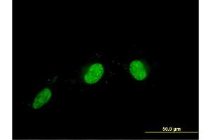 Immunofluorescence of monoclonal antibody to CALCOCO2 on HeLa cell. (CALCOCO2 Antikörper  (AA 347-446))