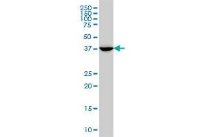 Western Blotting (WB) image for anti-Mevalonate (Diphospho) Decarboxylase (MVD) (AA 301-398) antibody (ABIN561884)
