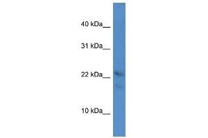Western Blot showing Omp antibody used at a concentration of 1. (OMP Antikörper  (C-Term))