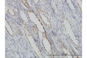 Immunostaining (ISt) image for anti-Calpain, Small Subunit 1 (CAPNS1) (AA 172-260) antibody (ABIN560162)
