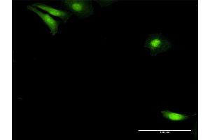 Immunofluorescence of purified MaxPab antibody to NUDC on HeLa cell. (NUDC Antikörper  (AA 1-331))