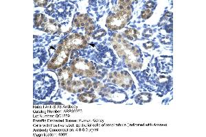 Human kidney (SIX Homeobox 6 Antikörper  (N-Term))