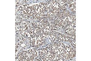 IHC analysis of SFXN3 using anti-SFXN3 antibody (ABIN7601302). (SFXN3 Antikörper  (AA 32-321))