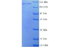 SDS-PAGE (SDS) image for Peroxisomal Bifunctional Enzyme (ECHP) (AA 1-723), (full length) protein (His-SUMO Tag) (ABIN5711237) (Peroxisomal Bifunctional Enzyme Protein (ECHP) (AA 1-723, full length) (His-SUMO Tag))