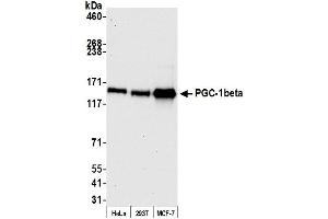 Western Blotting (WB) image for anti-Peroxisome Proliferator-Activated Receptor Gamma, Coactivator 1 beta (PPARGC1B) (AA 50-100) antibody (ABIN7449644)