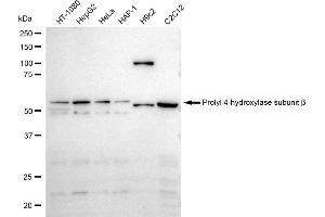 Western blotting analysis using Prolyl 4-hydroxylase subunit beta antibody (ABIN7799920).