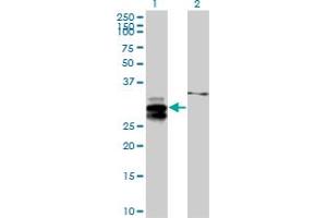 Western Blot analysis of ULBP2 expression in transfected 293T cell line by ULBP2 MaxPab polyclonal antibody. (ULBP2 Antikörper  (AA 1-246))