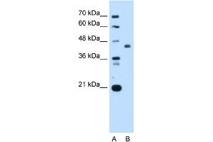 WB Suggested Anti-ST3GAL4 Antibody Titration:  0.