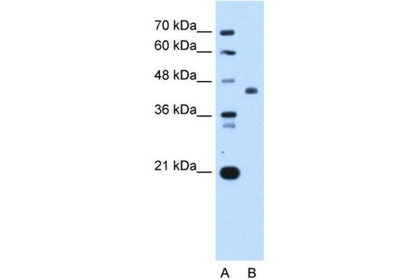 ST3GAL4 antibody  (Middle Region)