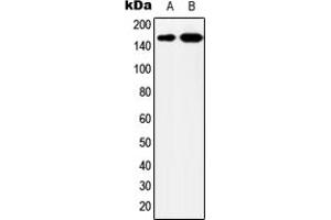 Western blot analysis of YEATS2 expression in MCF7 (A), HeLa (B) whole cell lysates. (YEATS2 Antikörper  (Center))