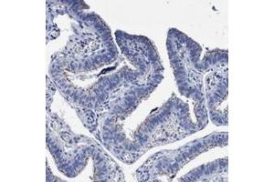 Immunohistochemical staining of human fallopian tube with CROCC polyclonal antibody  shows moderate membranous positivity in ciliated cells at 1:2500-1:5000 dilution. (CROCC Antikörper)